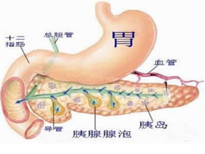 低分化胃癌症状的治疗方法护理