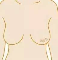 石家庄肿瘤医院教你预防乳腺癌