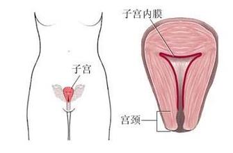 专家介绍你必要了解的子宫癌症状